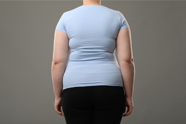 What is a belt lipectomy - Dr Matthew Peters | Brisbane Specialist Plastic Surgeon - 1